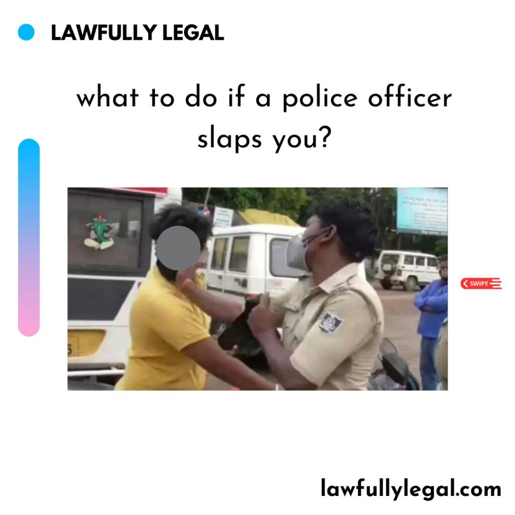 What to do if a police officer slaps you?